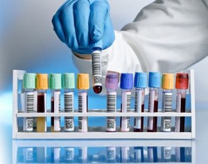lab-test-300x237